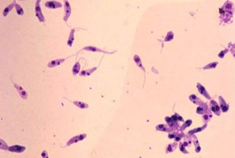 Cutaneous Leishmaniasis under microscope
